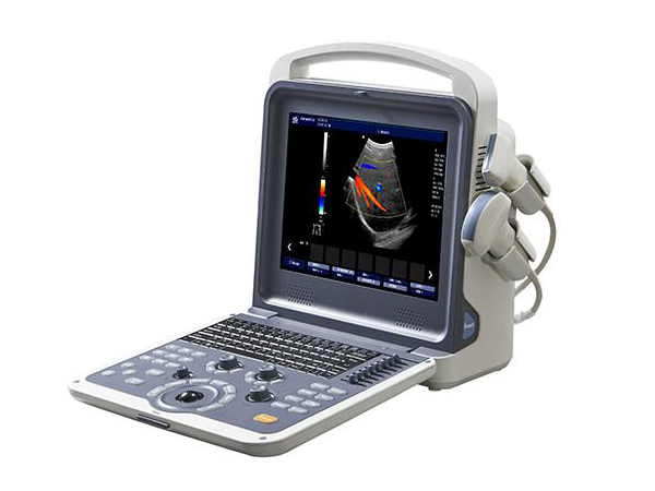 全数字彩色超声诊断系统